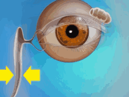 微信图片_20200306162520.gif