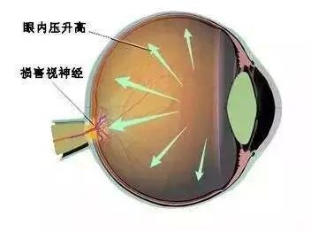 微信图片_20200422081751.jpg