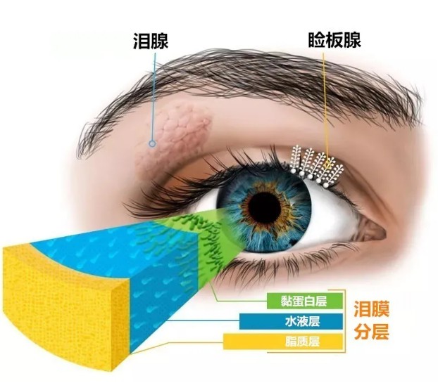 眼睛居然长起了 青春痘 你的睑板腺还好吗 江门五邑爱尔新希望眼科医院